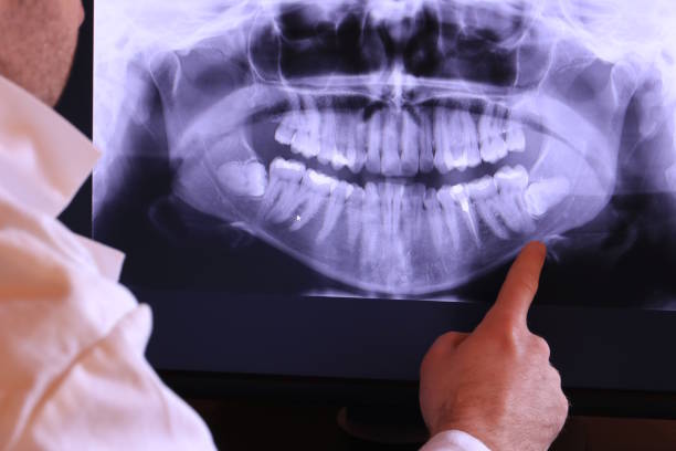 Best Emergency Root Canal Treatment in Deer Park, WA